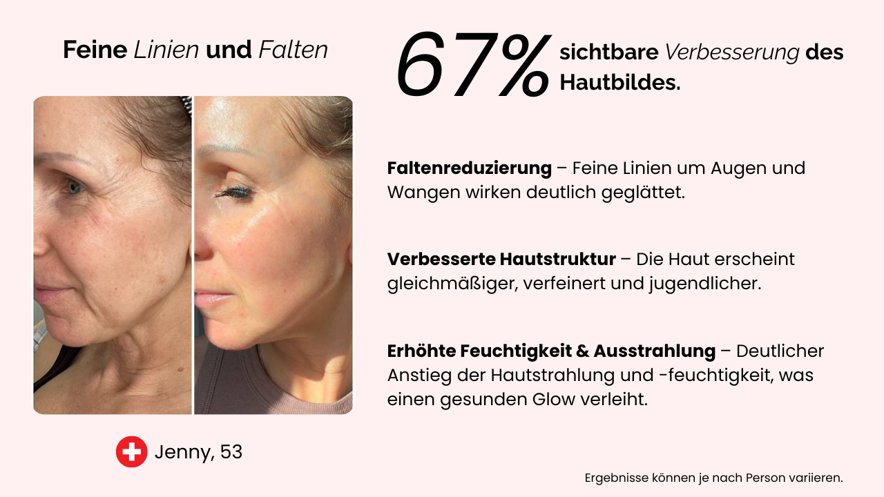 Folienbild